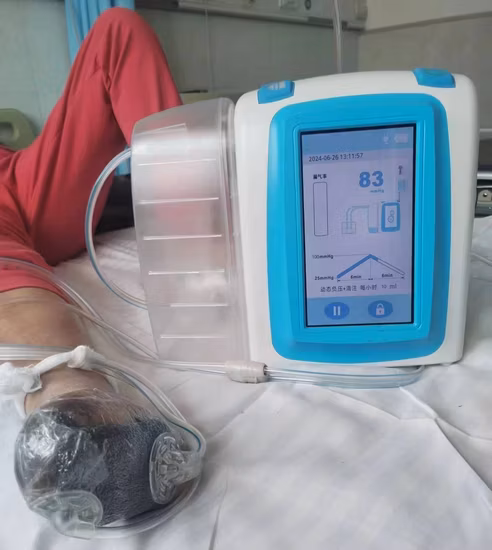 Unterdruck-Therapiesystem Npwt-Gerät zur Wundheilung mit 1200 Kanister